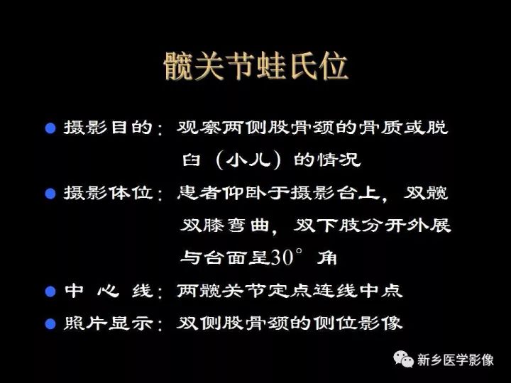 详细的髋关节X线解剖+摄影技术+测量方法 详细的髋关节X线解剖+摄影技术+测量方法
