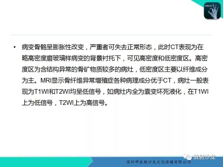 【病例】骨促结缔组织增生性纤维瘤1例CT