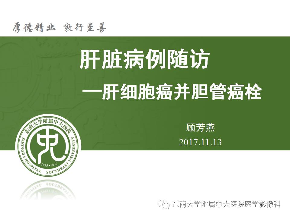 【病例】肝细胞癌合并胆管癌栓1例CT及MR影像表现 【病例】肝细胞癌合并胆管癌栓1例CT及MR影像表现