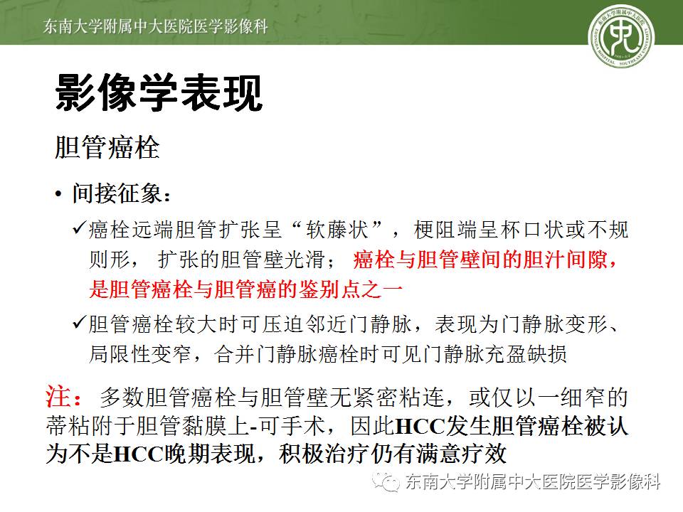 【病例】肝细胞癌合并胆管癌栓1例CT及MR影像表现 【病例】肝细胞癌合并胆管癌栓1例CT及MR影像表现