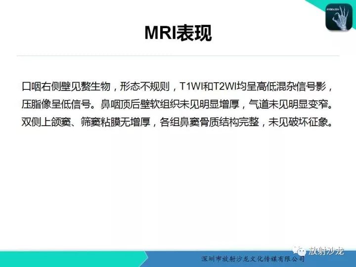 【病例】咽部畸胎瘤1例MR影像表现