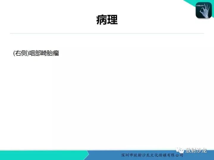 【病例】咽部畸胎瘤1例MR影像表现