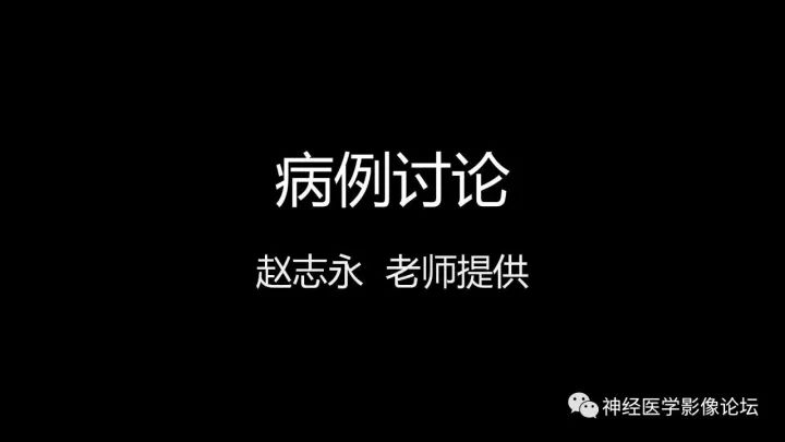【病例】靠近脑表累及脑膜室管膜瘤1例MR