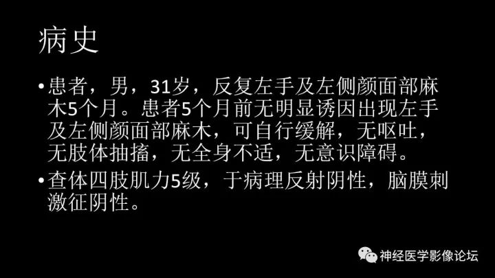 【病例】靠近脑表累及脑膜室管膜瘤1例MR