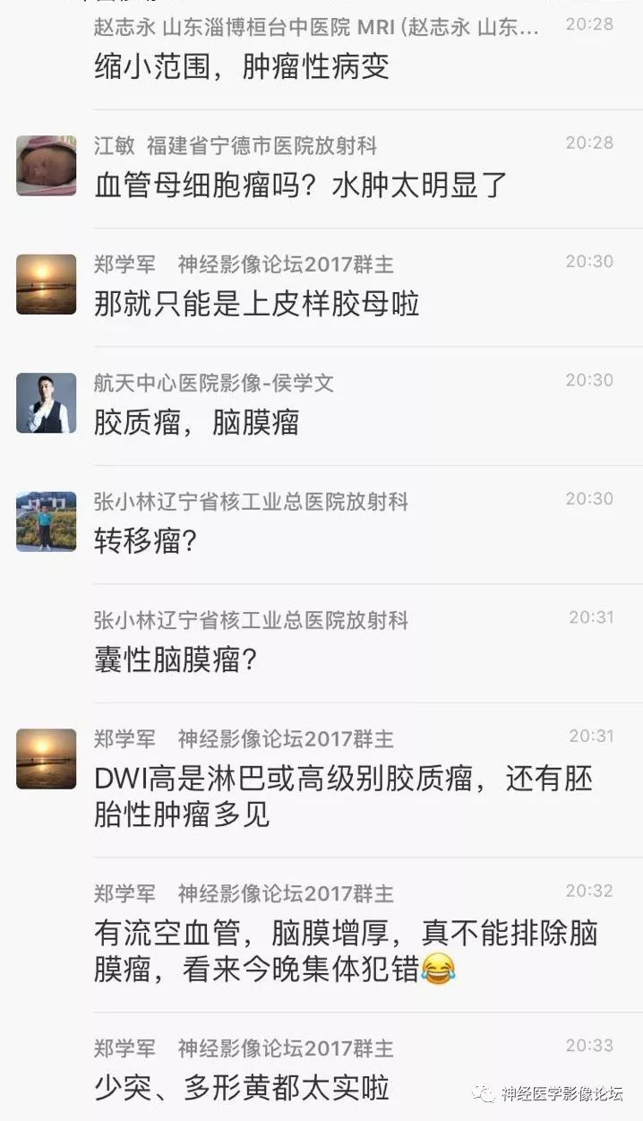 【病例】靠近脑表累及脑膜室管膜瘤1例MR