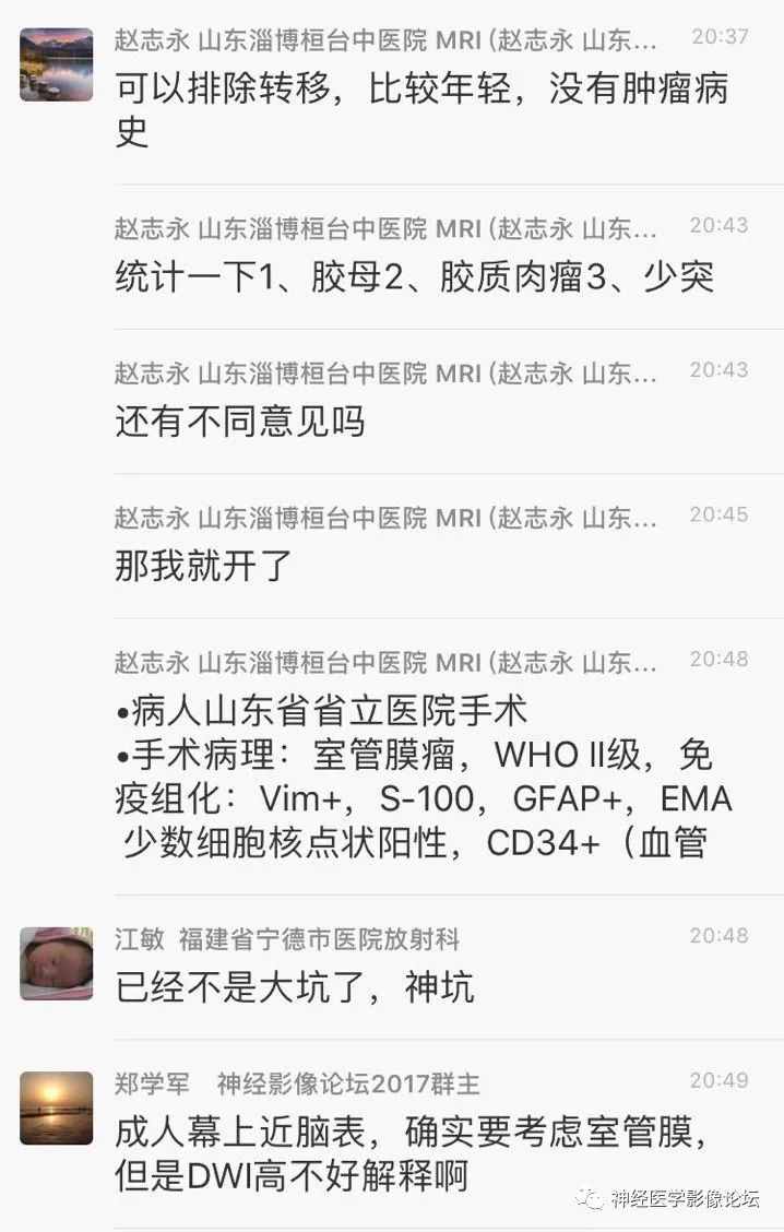 【病例】靠近脑表累及脑膜室管膜瘤1例MR