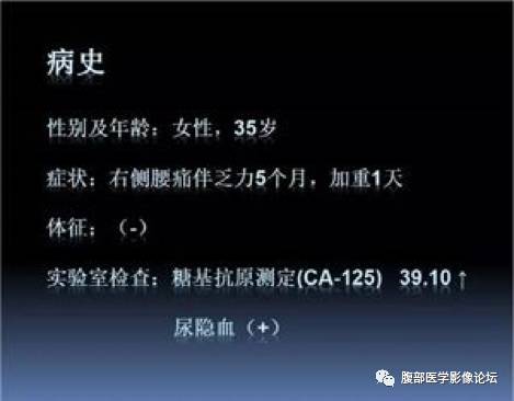 【病例】右肾混合性上皮和间质肿瘤1例CT 【病例】右肾混合性上皮和间质肿瘤1例CT