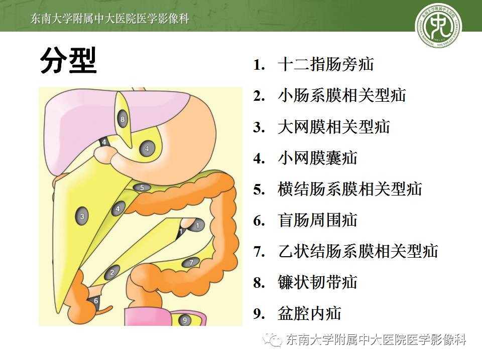 【病例】Meckel憩室伴小肠系膜相关型疝1例