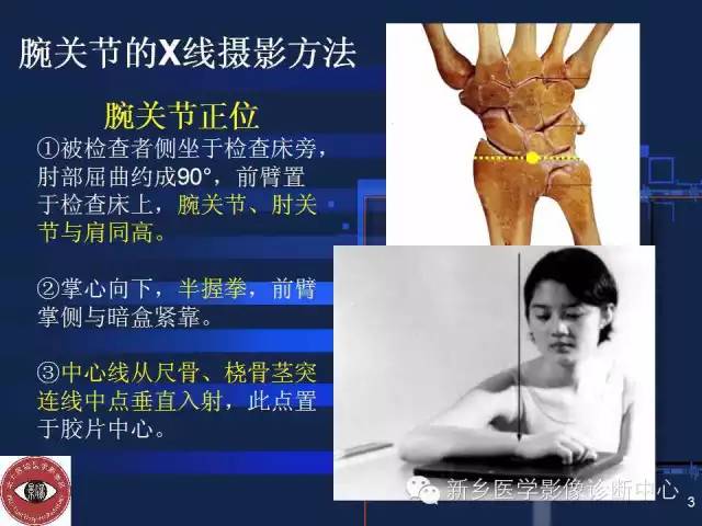 详细的腕关节X线解剖+摄影技巧+阅片技巧+测量 详细的腕关节X线解剖+摄影技巧+阅片技巧+测量