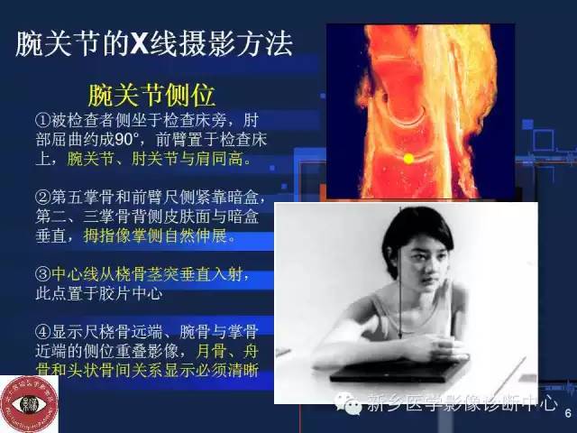 详细的腕关节X线解剖+摄影技巧+阅片技巧+测量 详细的腕关节X线解剖+摄影技巧+阅片技巧+测量