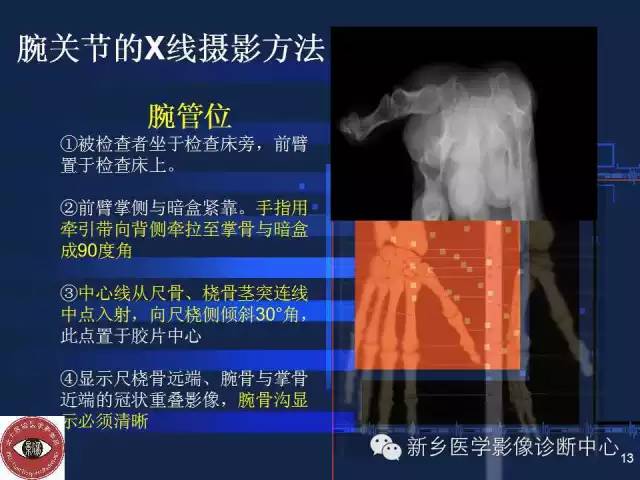 详细的腕关节X线解剖+摄影技巧+阅片技巧+测量 详细的腕关节X线解剖+摄影技巧+阅片技巧+测量