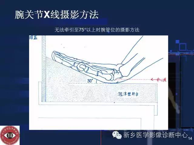 详细的腕关节X线解剖+摄影技巧+阅片技巧+测量 详细的腕关节X线解剖+摄影技巧+阅片技巧+测量