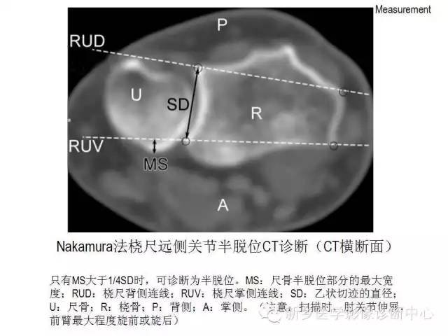 详细的腕关节X线解剖+摄影技巧+阅片技巧+测量 详细的腕关节X线解剖+摄影技巧+阅片技巧+测量