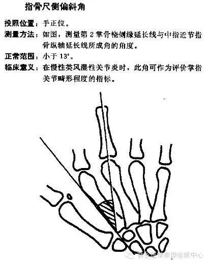 详细的腕关节X线解剖+摄影技巧+阅片技巧+测量 详细的腕关节X线解剖+摄影技巧+阅片技巧+测量