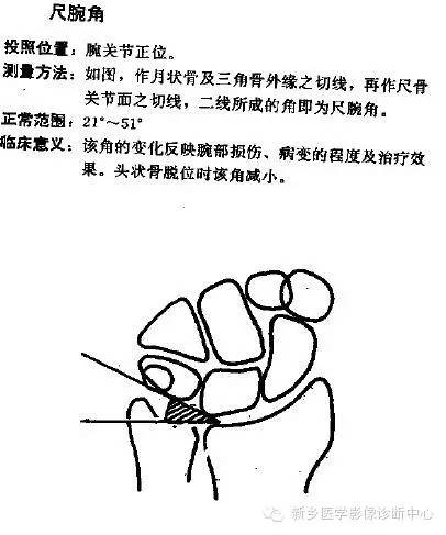 详细的腕关节X线解剖+摄影技巧+阅片技巧+测量 详细的腕关节X线解剖+摄影技巧+阅片技巧+测量