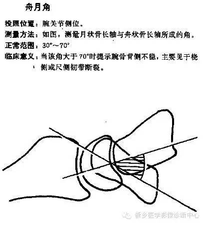 详细的腕关节X线解剖+摄影技巧+阅片技巧+测量 详细的腕关节X线解剖+摄影技巧+阅片技巧+测量