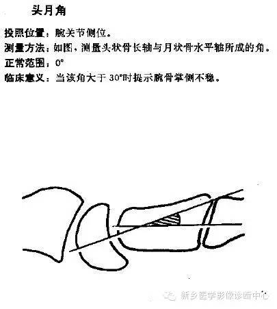 详细的腕关节X线解剖+摄影技巧+阅片技巧+测量 详细的腕关节X线解剖+摄影技巧+阅片技巧+测量