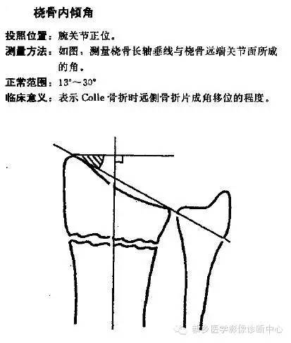 详细的腕关节X线解剖+摄影技巧+阅片技巧+测量 详细的腕关节X线解剖+摄影技巧+阅片技巧+测量
