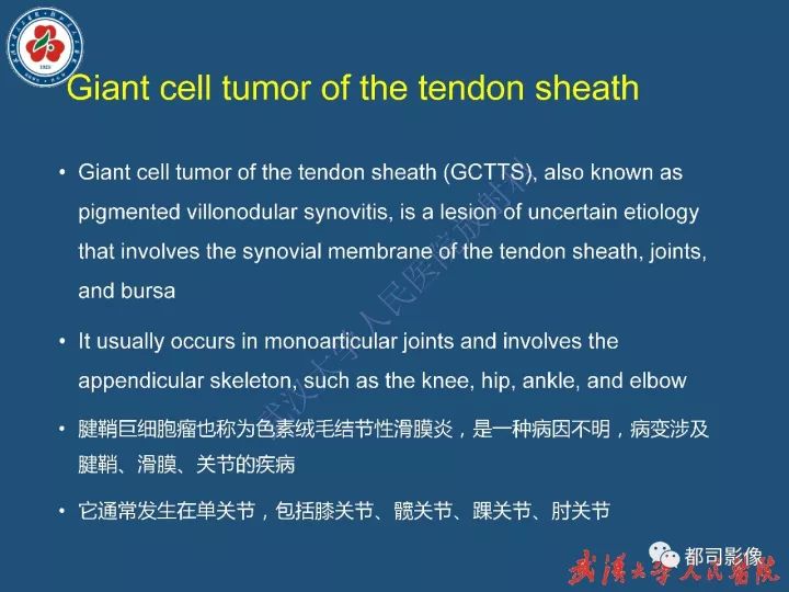 【病例】寰椎及枕骨弥漫性腱鞘巨细胞瘤1例CT及MR影像诊断