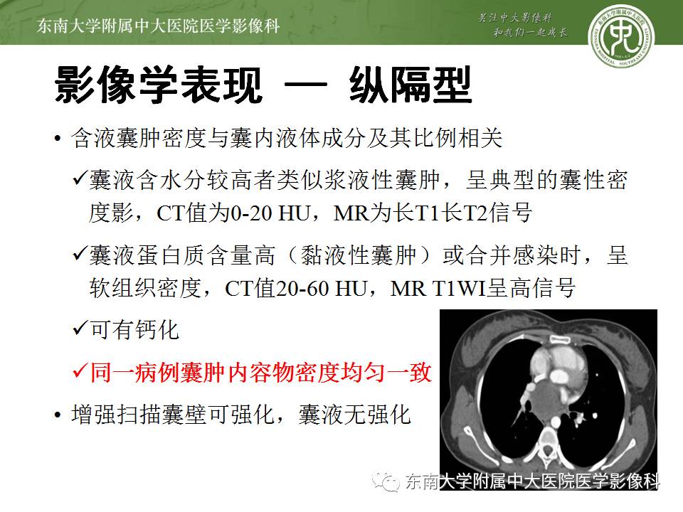 【病例】肺内含液支气管囊肿1例CT影像表现