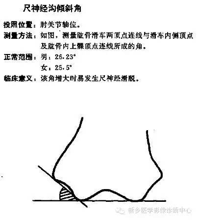 详细的肘关节X线解剖+摄影技巧+骨骺时间+测量方法 详细的肘关节X线解剖+摄影技巧+骨骺时间+测量方法