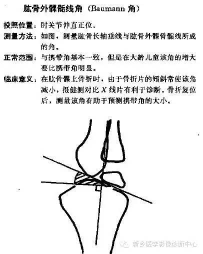 详细的肘关节X线解剖+摄影技巧+骨骺时间+测量方法 详细的肘关节X线解剖+摄影技巧+骨骺时间+测量方法