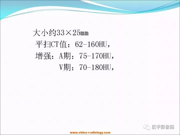 【病例】小肠平滑肌瘤1例CT影像表现