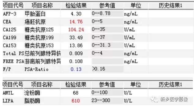 【病例】胰腺假性囊肿1例CT影像表现 【病例】胰腺假性囊肿1例CT影像表现