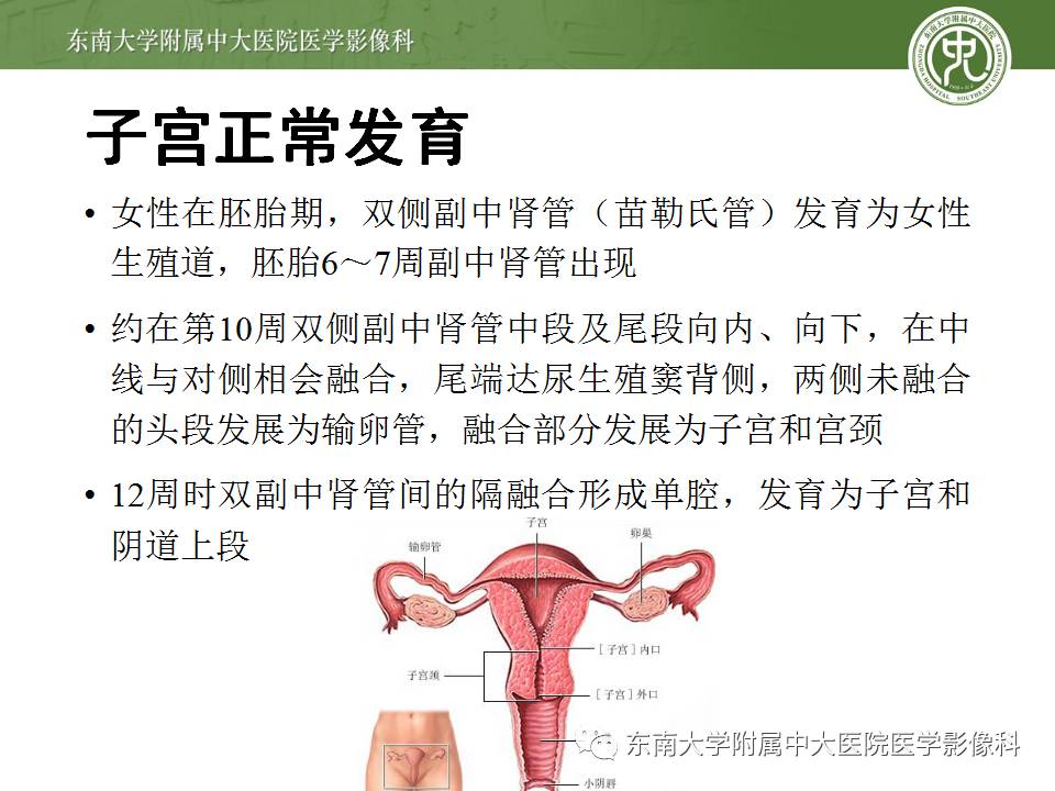【病例】子宫发育畸形(纵隔子宫)1例MR