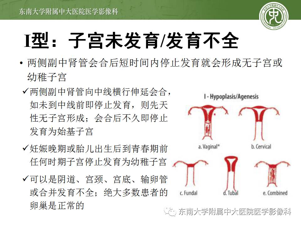 【病例】子宫发育畸形(纵隔子宫)1例MR