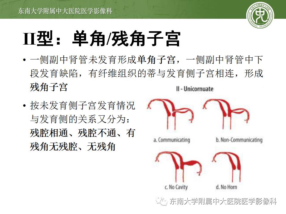 【病例】子宫发育畸形(纵隔子宫)1例MR