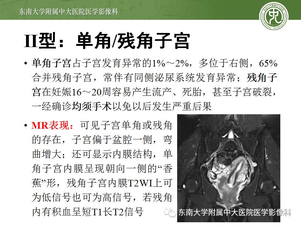 【病例】子宫发育畸形(纵隔子宫)1例MR