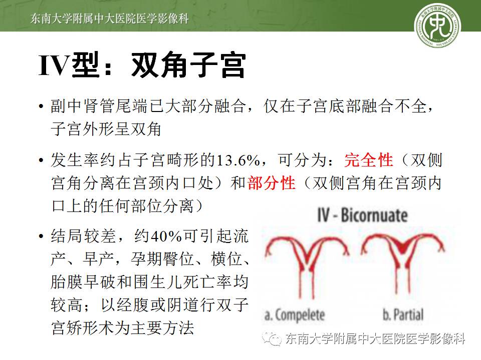 【病例】子宫发育畸形(纵隔子宫)1例MR
