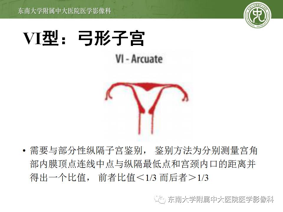 【病例】子宫发育畸形(纵隔子宫)1例MR