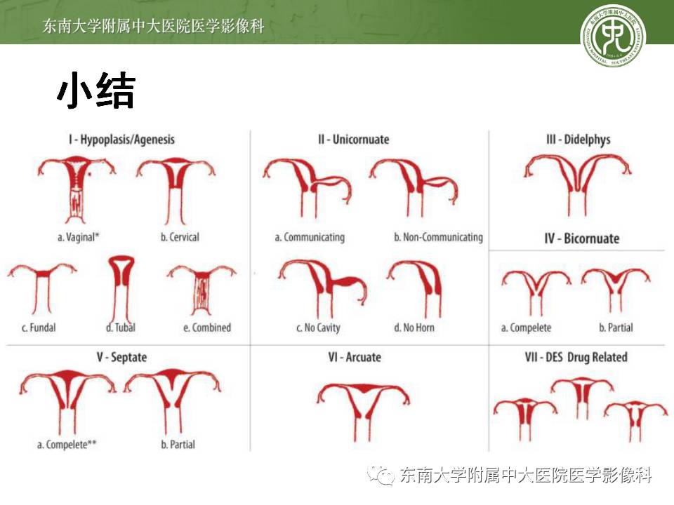 【病例】子宫发育畸形(纵隔子宫)1例MR