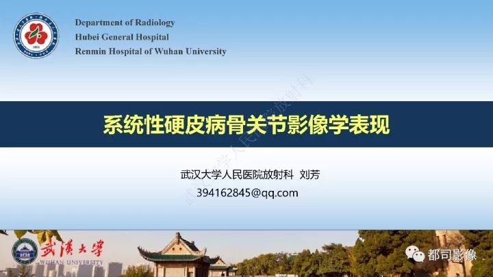 【病例】系统性硬皮病1例骨关节X线影像学表现