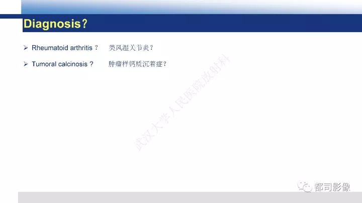 【病例】系统性硬皮病1例骨关节X线影像学表现