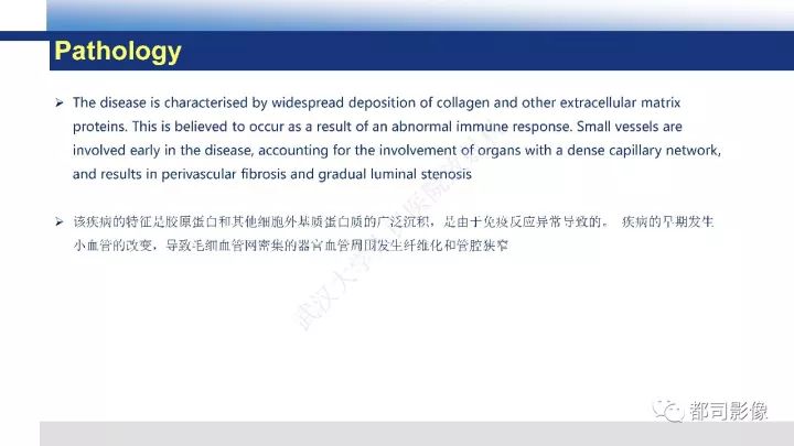 【病例】系统性硬皮病1例骨关节X线影像学表现