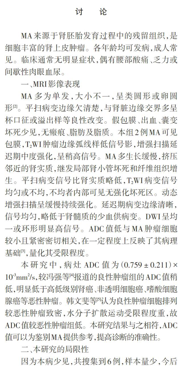 成人后肾腺瘤的MRI特征 成人后肾腺瘤的MRI特征