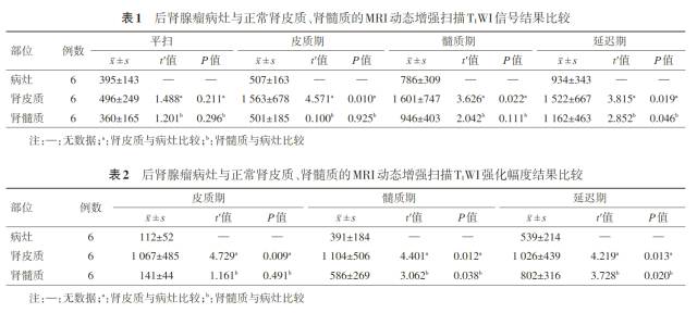 成人后肾腺瘤的MRI特征 成人后肾腺瘤的MRI特征
