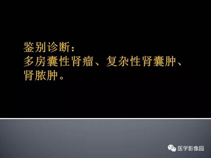 【病例】多房囊性肾癌1例CT及MR影像表现