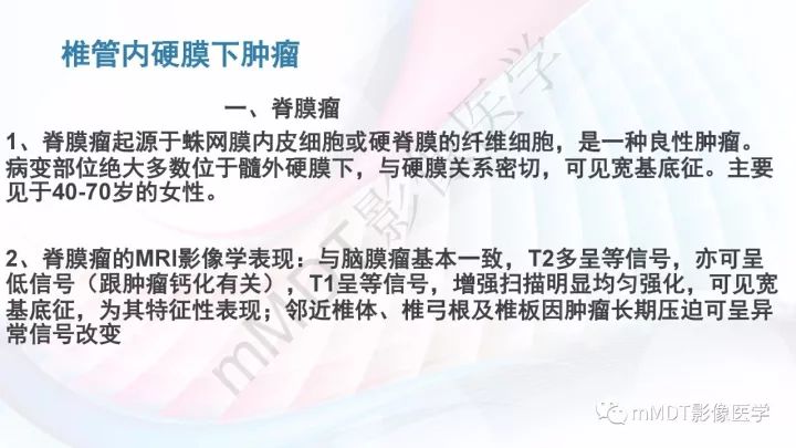 【PPT】椎管内髓外肿瘤