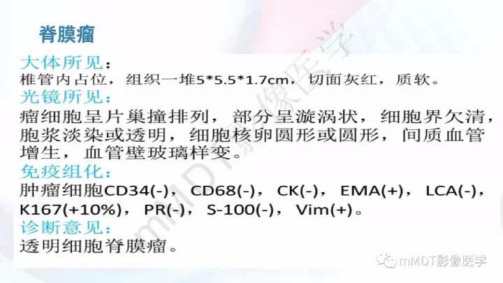 【PPT】椎管内髓外肿瘤