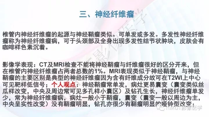 【PPT】椎管内髓外肿瘤