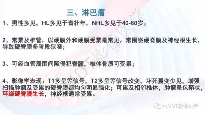 【PPT】椎管内髓外肿瘤