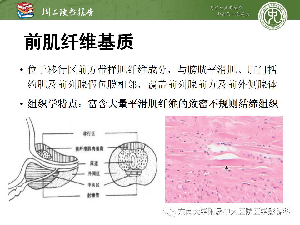 【PPT】MR易误诊为前列腺癌的良性表现：影像-病理相关性