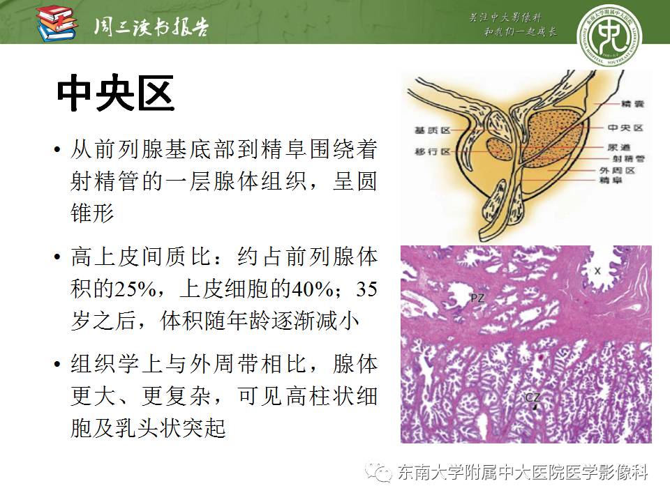 【PPT】MR易误诊为前列腺癌的良性表现：影像-病理相关性