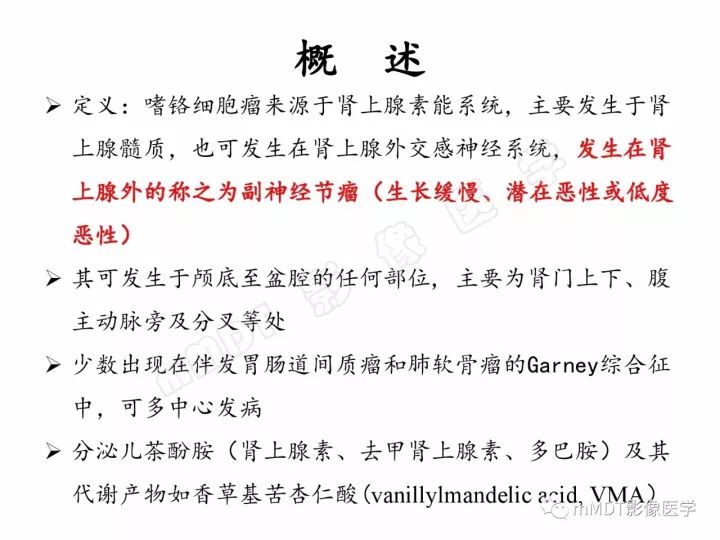 【PPT】腹膜后副神经节瘤影像诊断