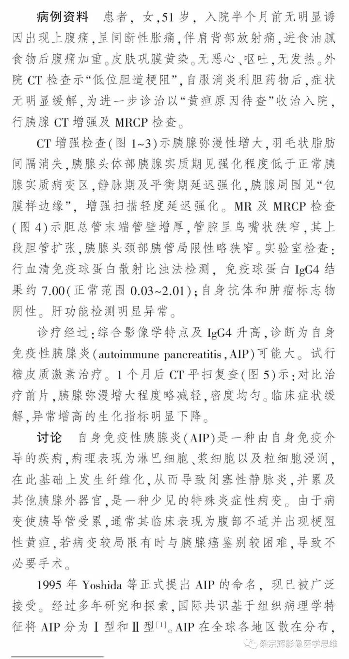 【病例】自身免疫性胰腺炎1例CT及MR影像诊断思路分析