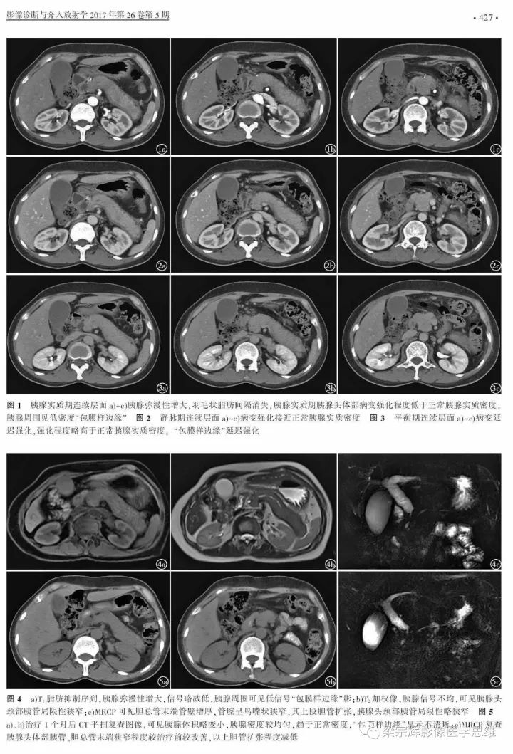 【病例】自身免疫性胰腺炎1例CT及MR影像诊断思路分析